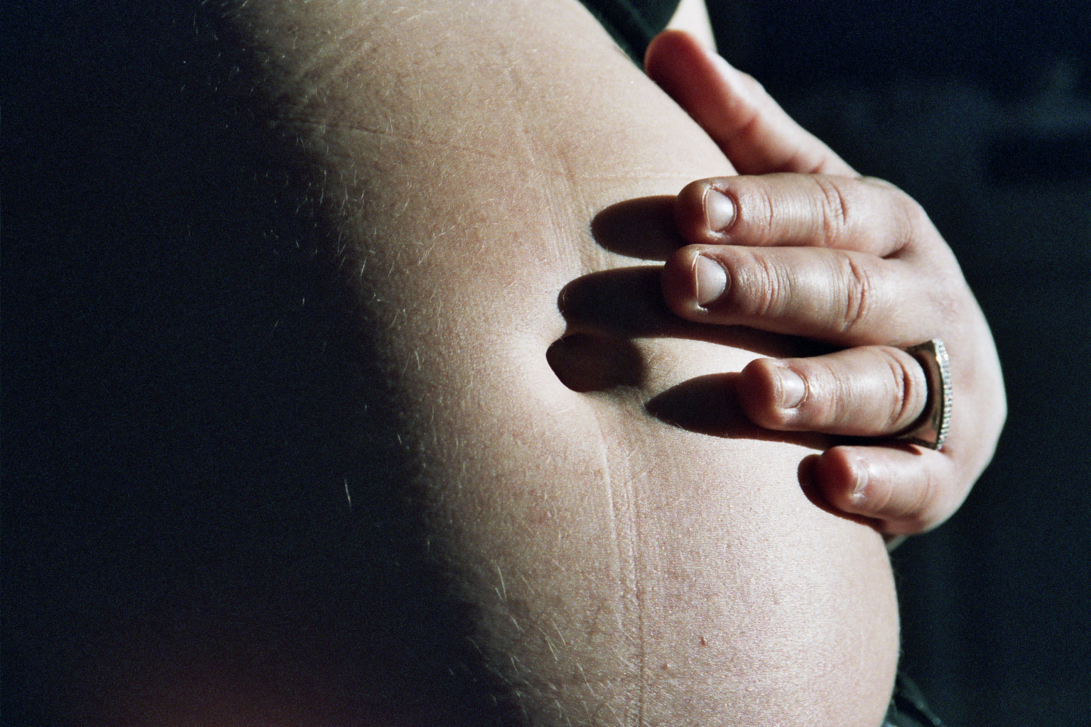 Even a Little Overweight is Bad for Baby