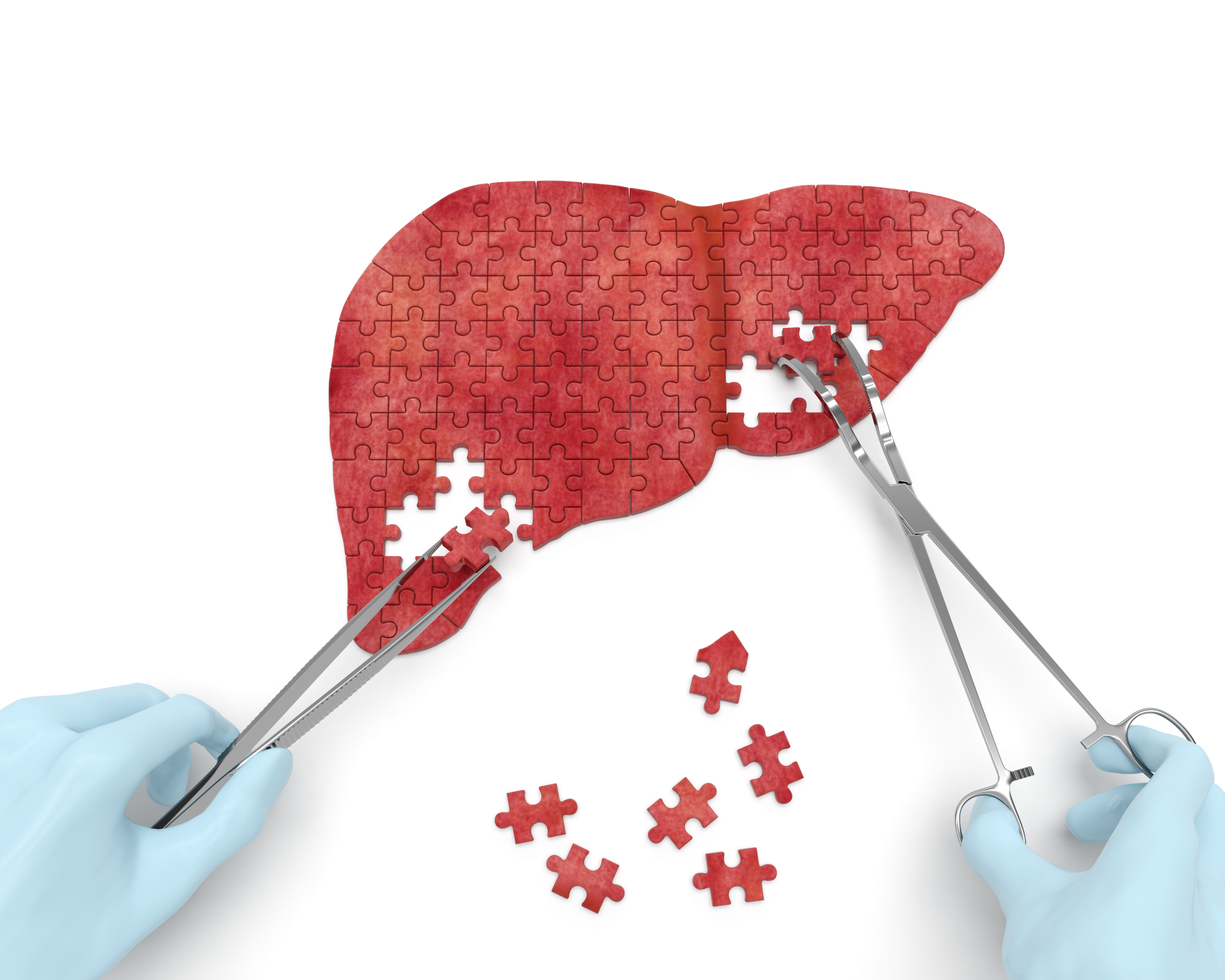 Why the Hepatitis C 'Cure' Rate Spiked