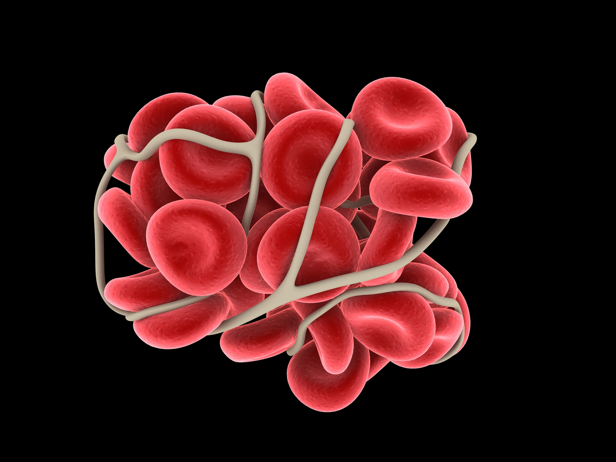 New VTE Guidelines Released