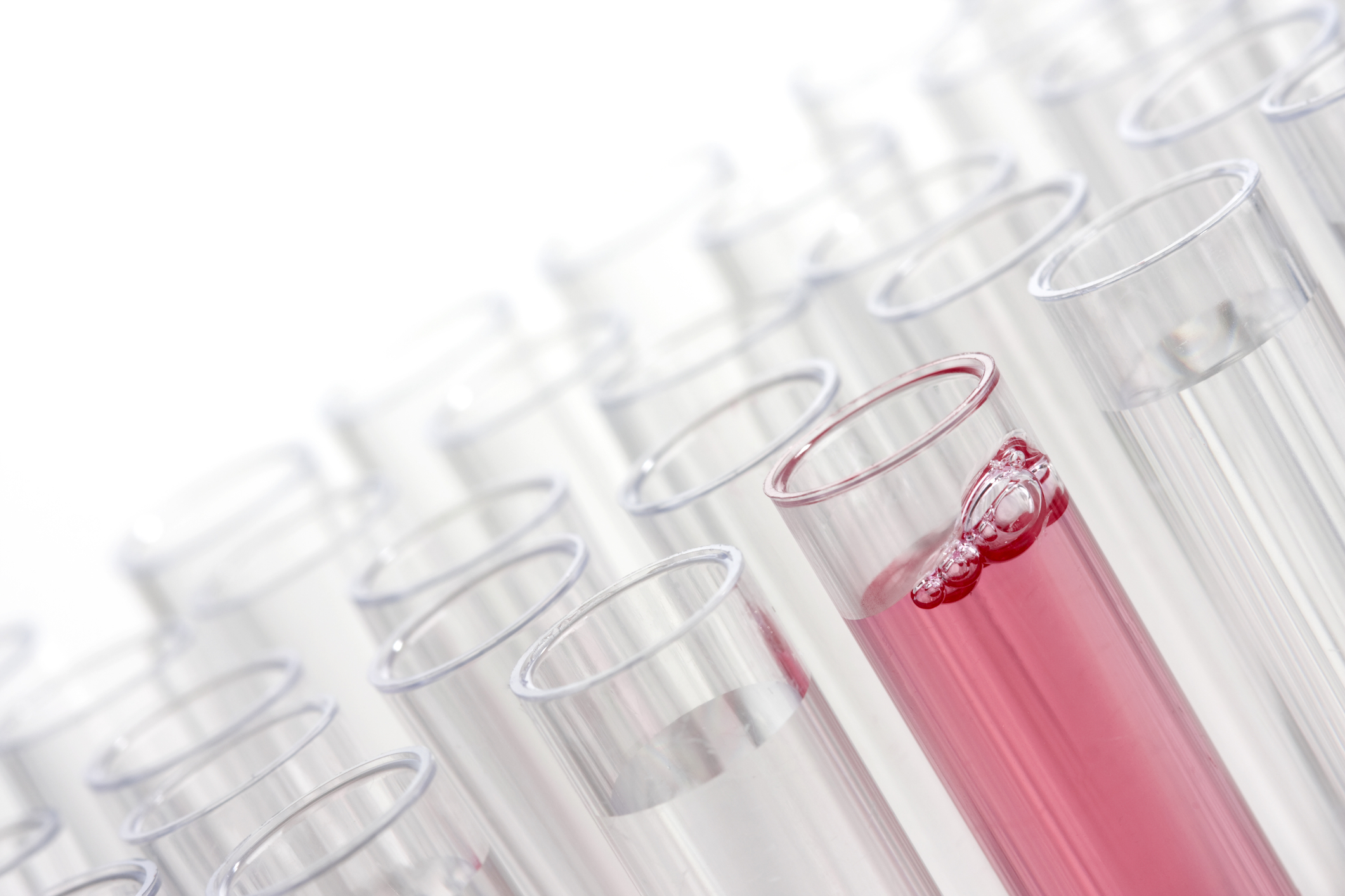 The Effect of BRCA Testing on Breast Cancer Treatment