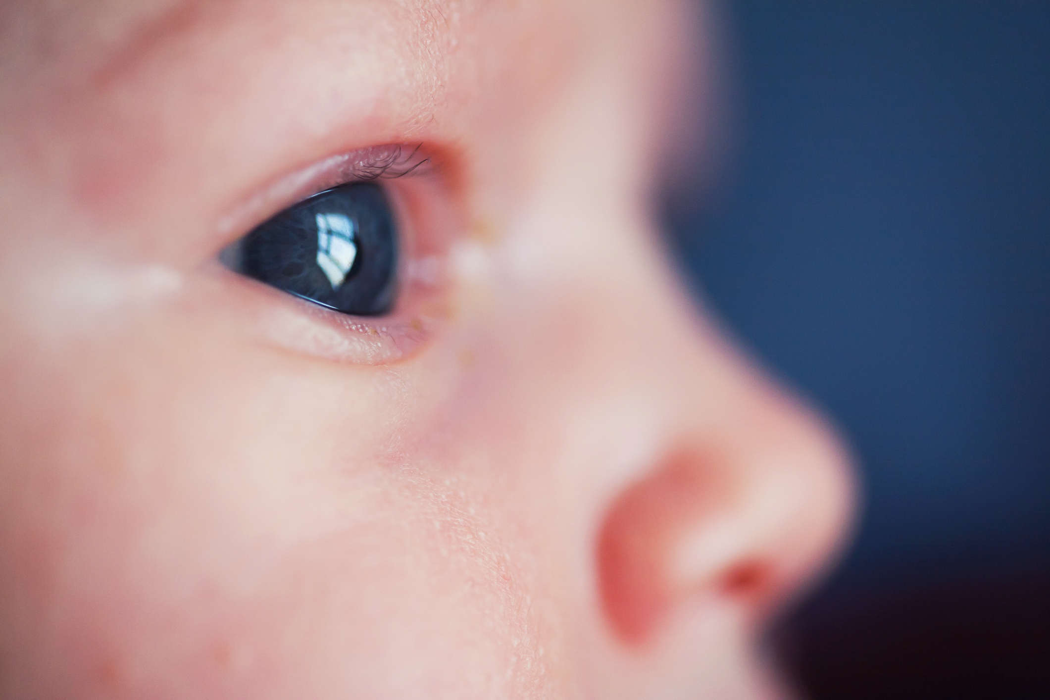 Keeping an Eye on Infant Eye Disease