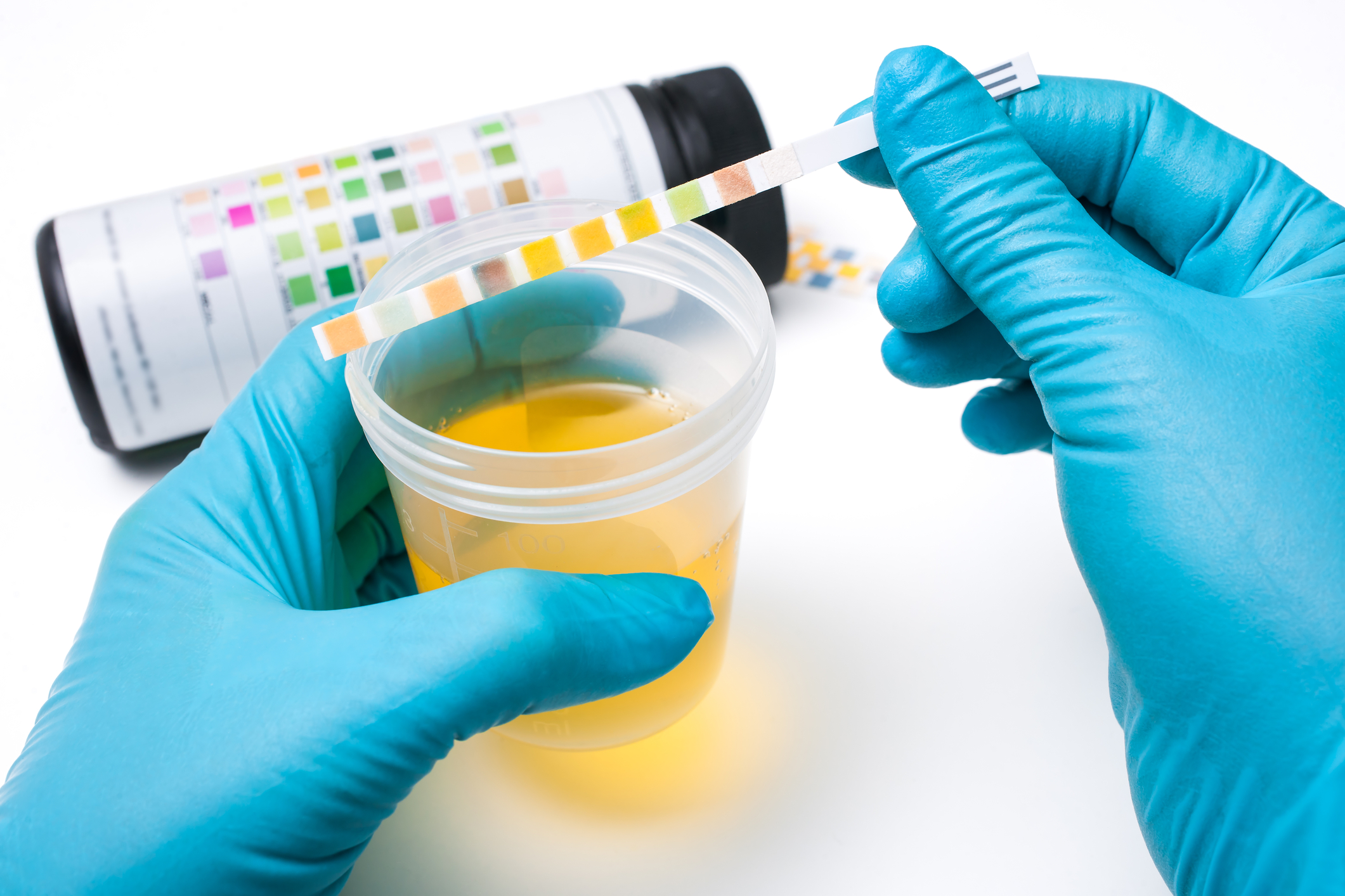 A One-Step Test to Detect Hep C