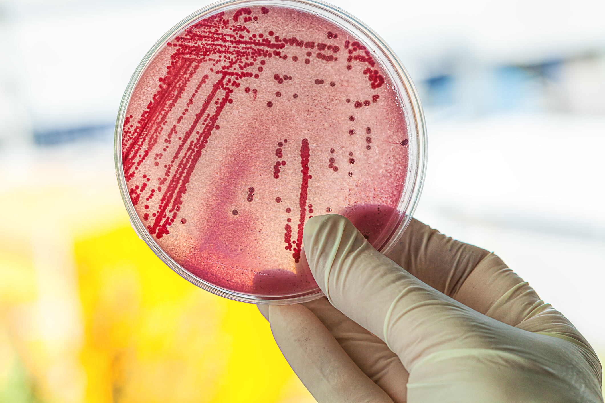 Rx-Resistant E. Coli: An Emerging Threat