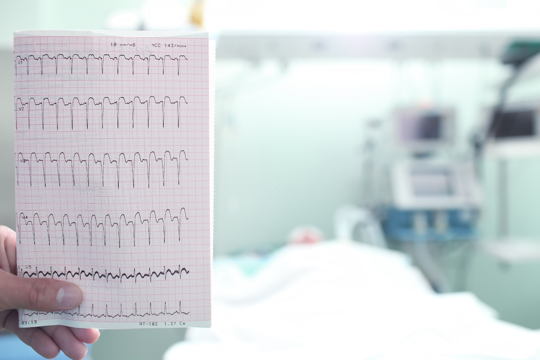 A Risky Time for Cardiogenic Shock Patients