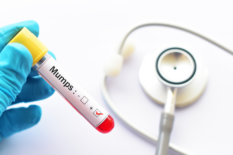Mumps Cases on the Rise