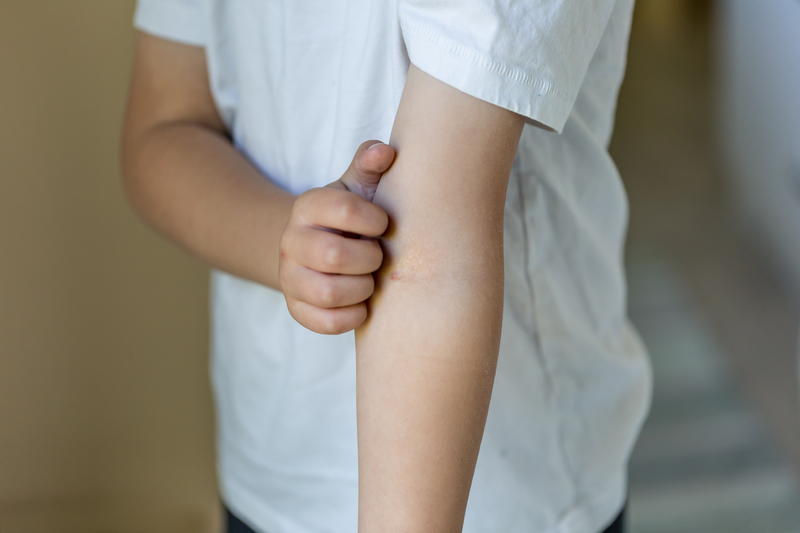 Eczema Rx for Kids Gets Green Light