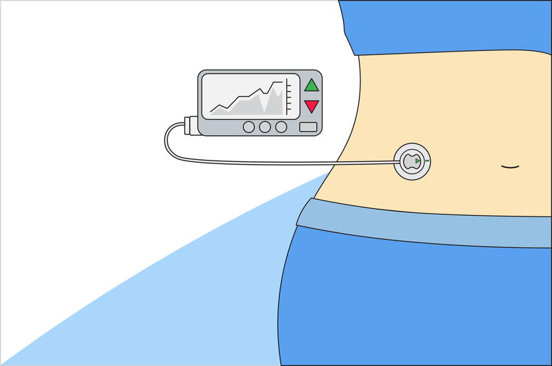 Cybersecurity Risks and Insulin Pumps