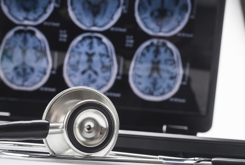 Alzheimer's Disease 101