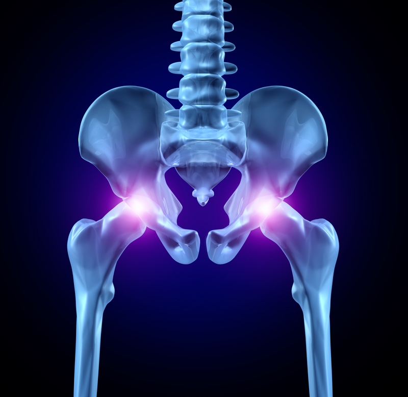 After Knee Replacement, Watch Your Hips