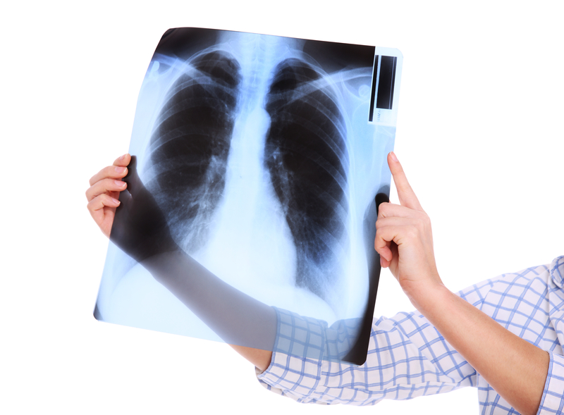 Good News for Older Patients with Lung Cancer 