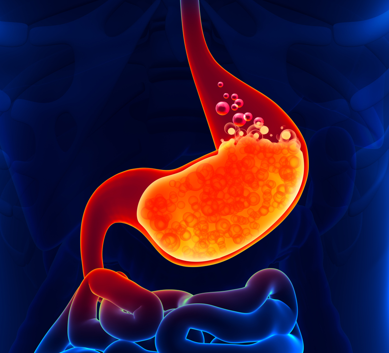 Treating Heartburn? Avoid These Medications
