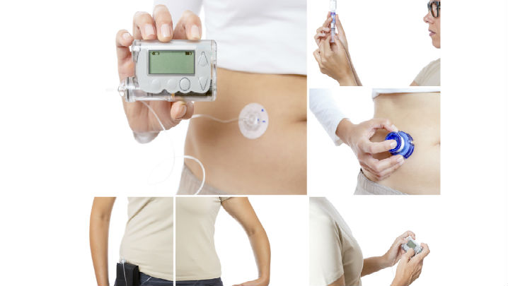 'Artificial Pancreas' Approved