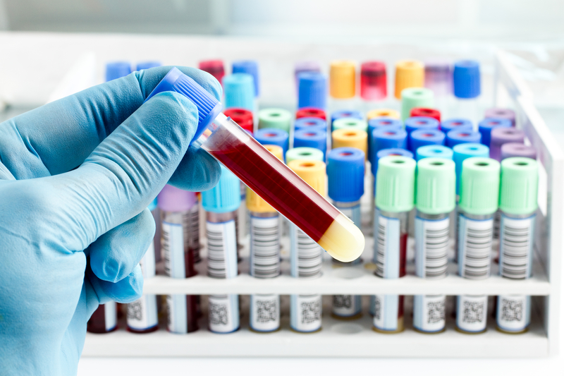 HIV Risk: Don't Guess, Get a Test