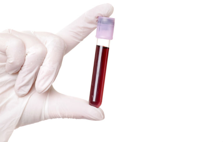 Ovarian Cancer Screening: A Warning