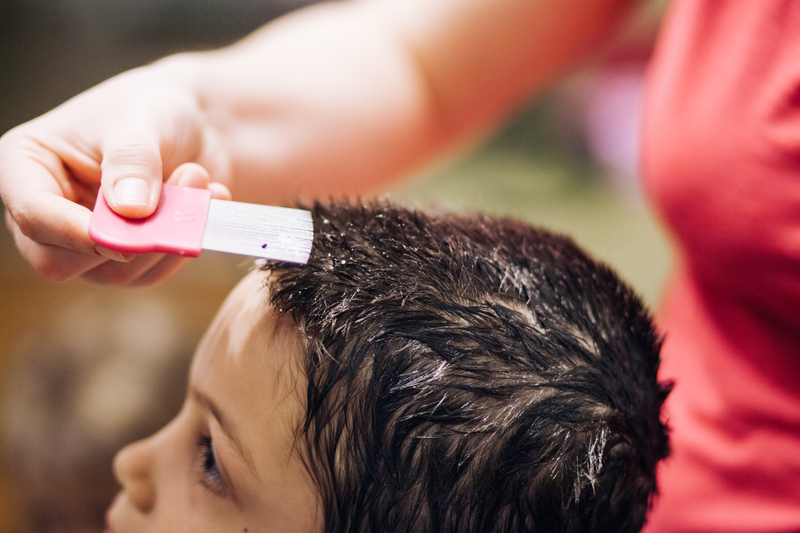 Common Lice Treatment Approved as OTC