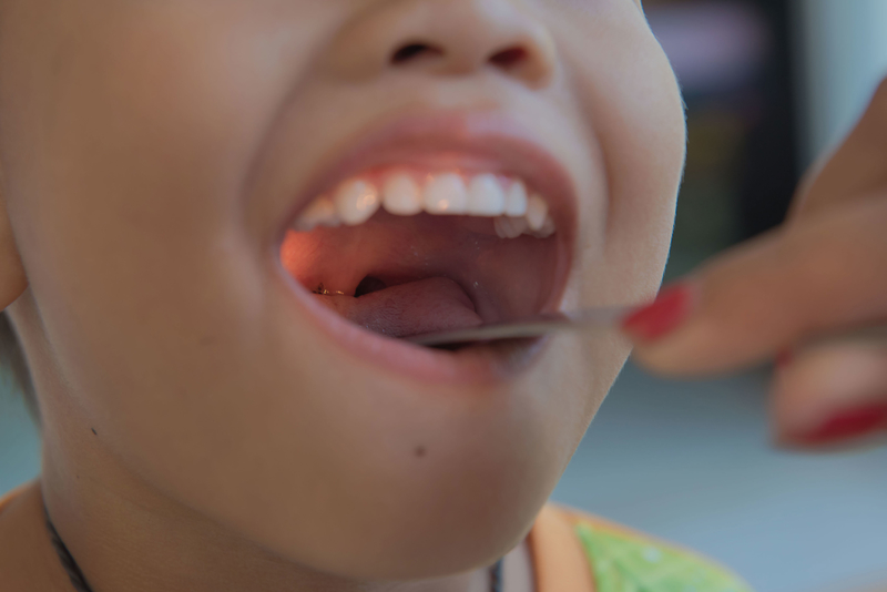 Out with It: New Tonsillectomy Guidelines