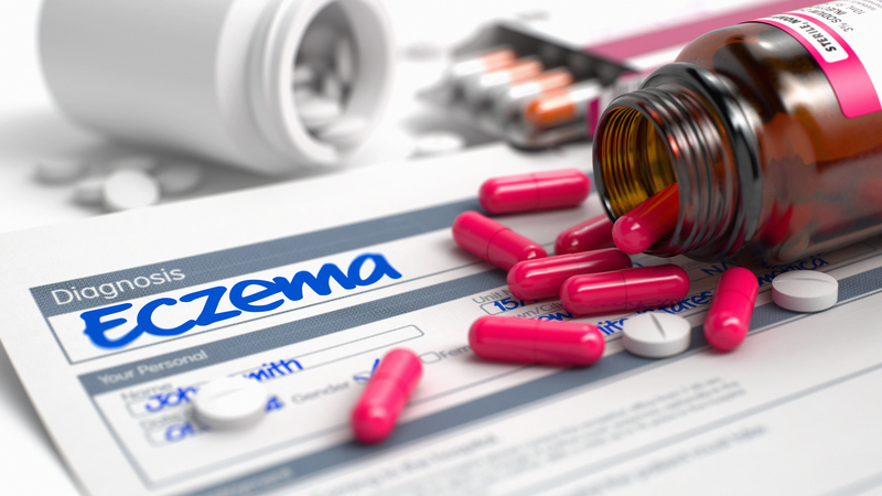 Options for Eczema