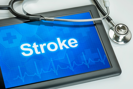 As Strokes Decline, Men May See the Benefits