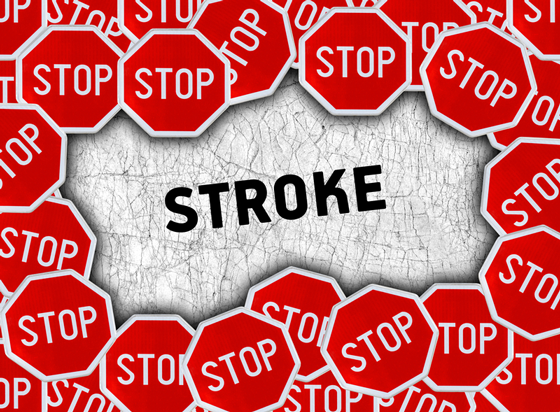 A Roadblock in Stroke Prevention