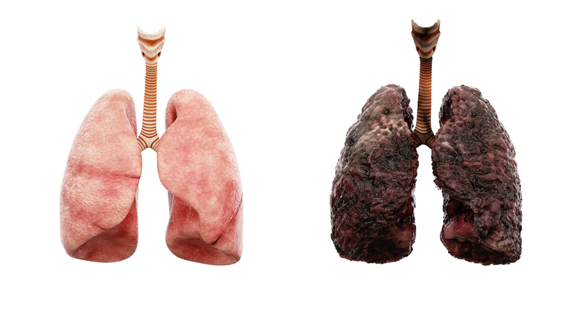 A Look at Nicotine Replacement Therapy