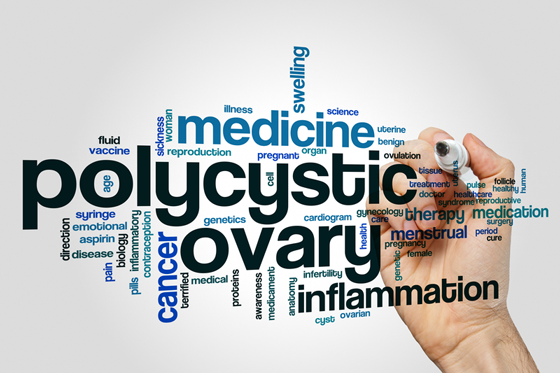 PCOS: Why Definitions Matter
