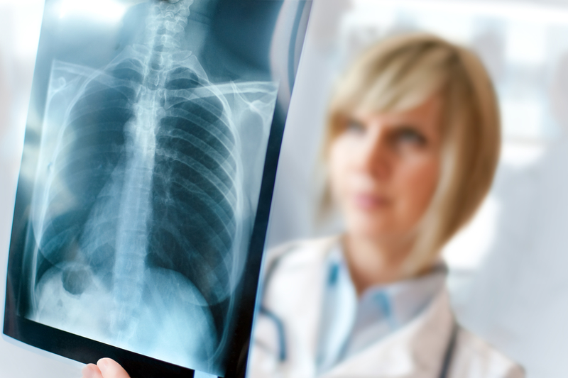 Plus One for Lung Cancer Surgery