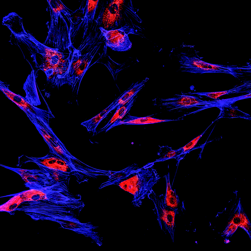 Approved: New Imaging Rx for Ovarian Cancer