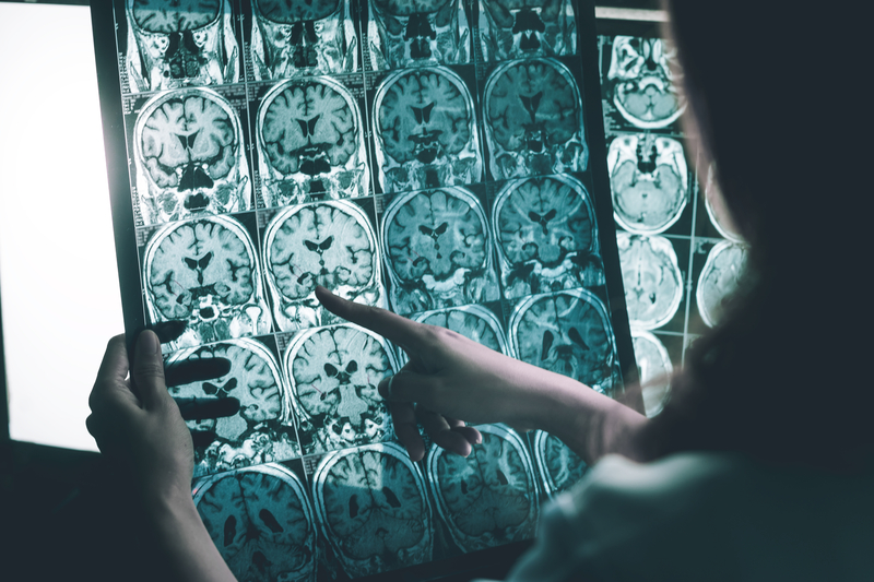 Approved: First Drug to Image Alzheimer’s Marker
