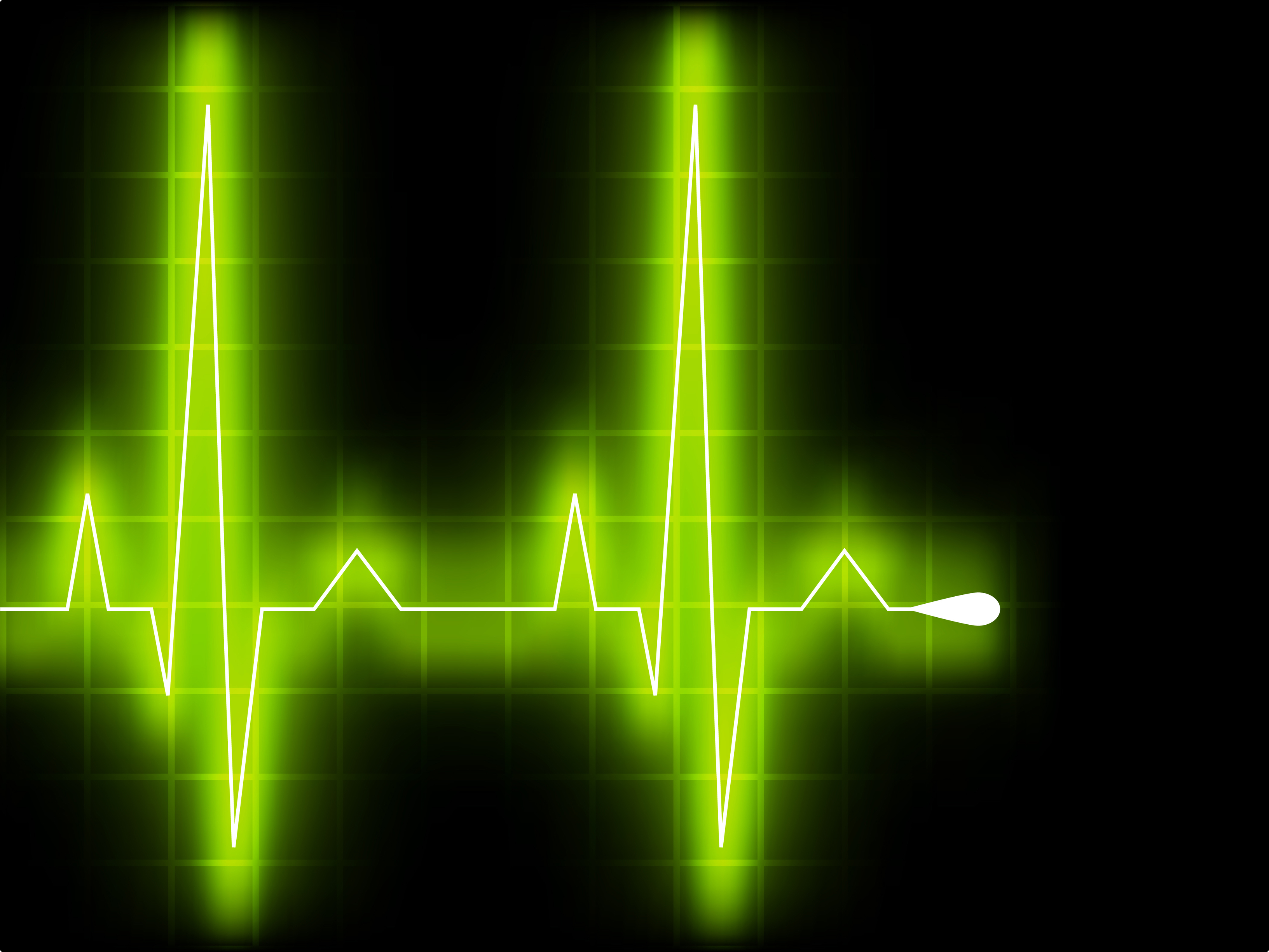 Electronics May Zap Your Pacemaker