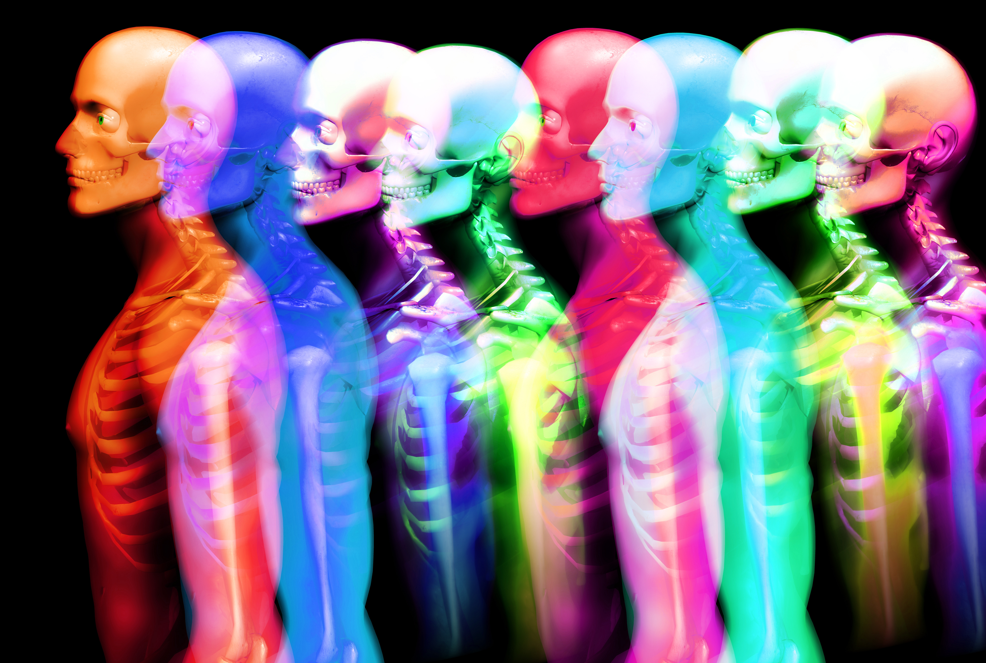 Multiple Sclerosis Quickly Affects Bone Health