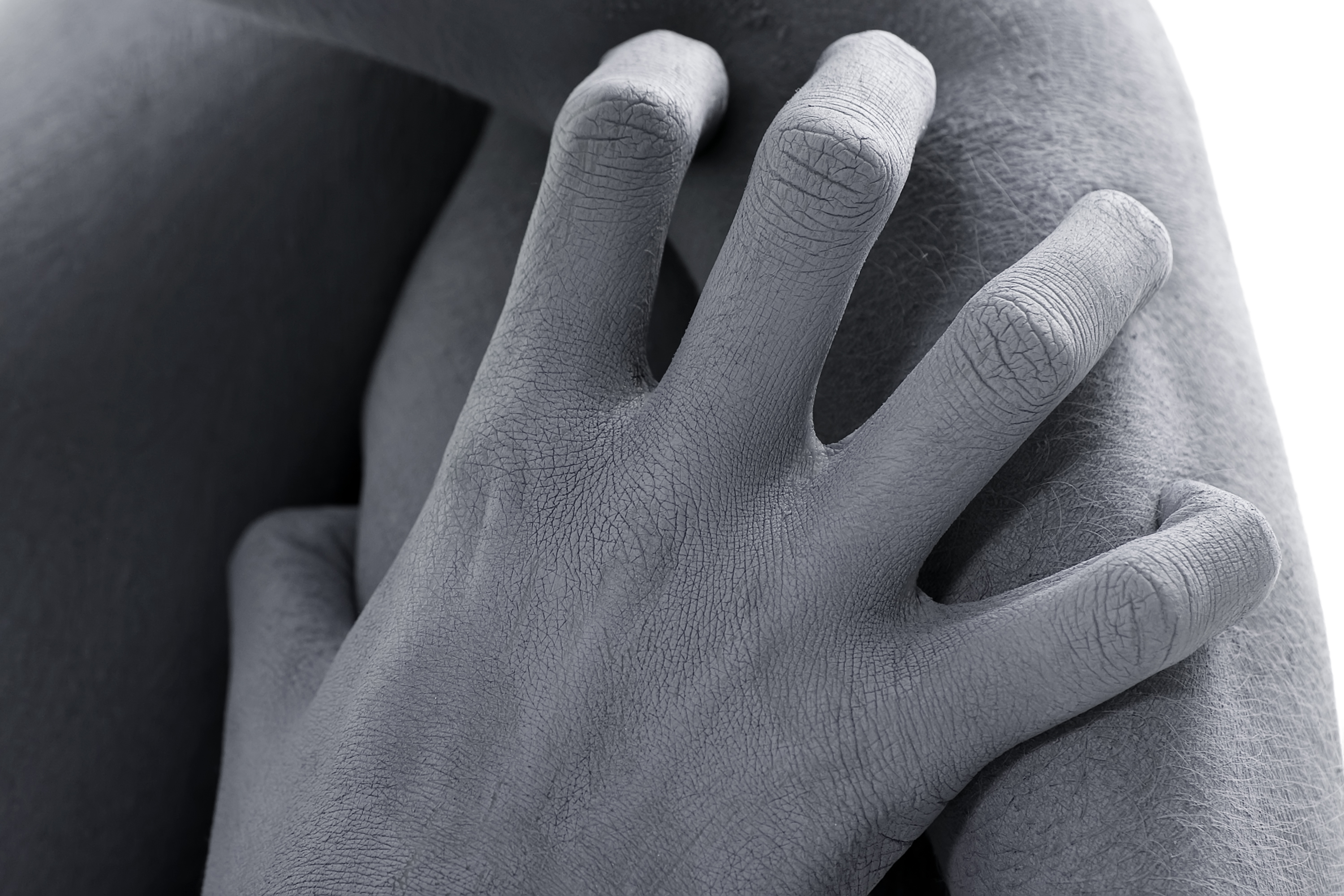 Shingles Recurrence More Common Than Believed