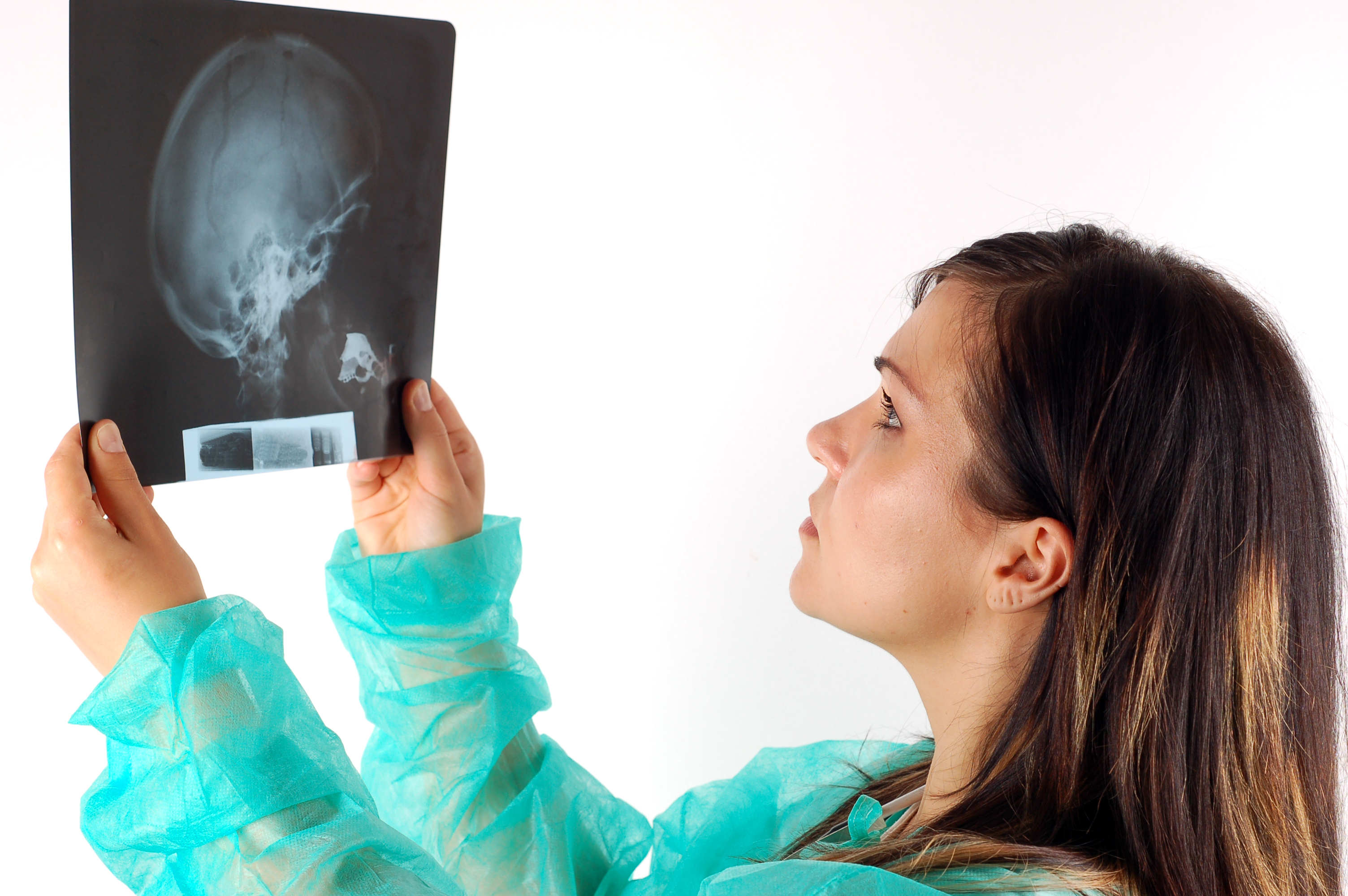 Strong Relationship Between Epilepsy and Psychiatric Illness