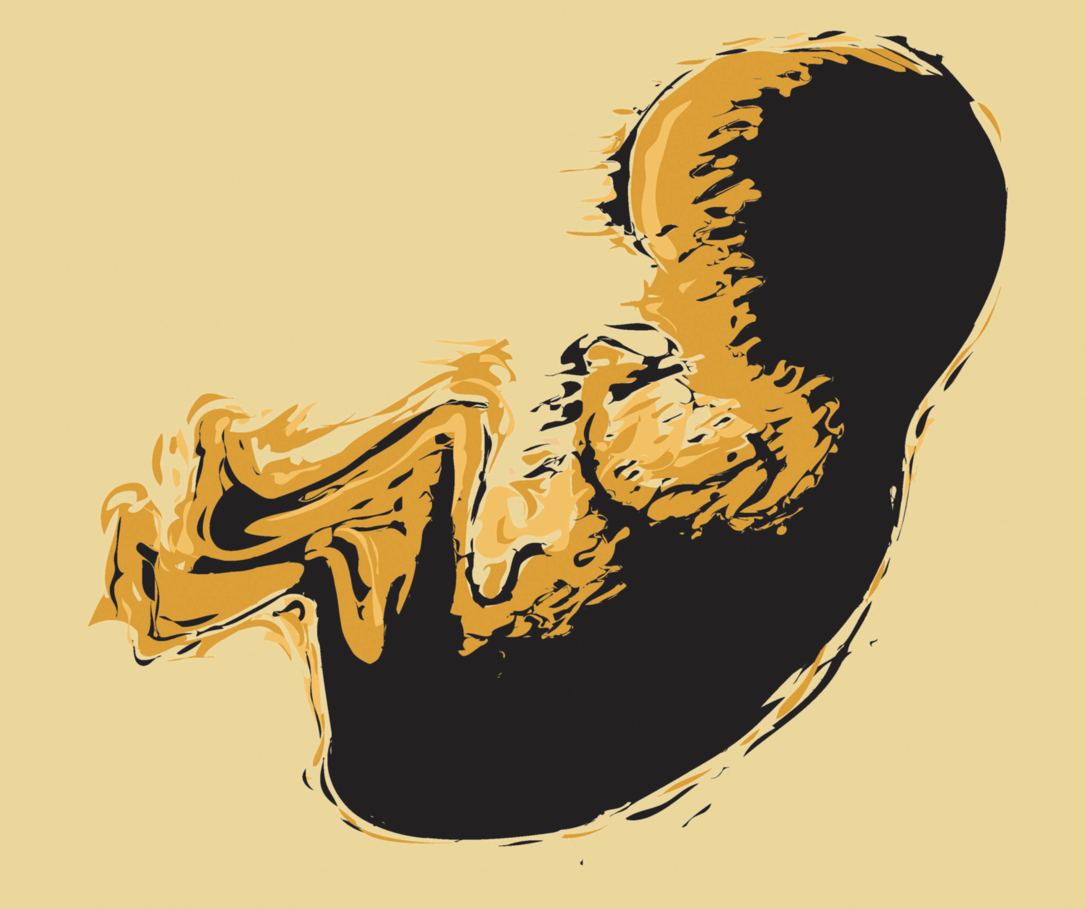 Stimulating Ovaries in Older Women 