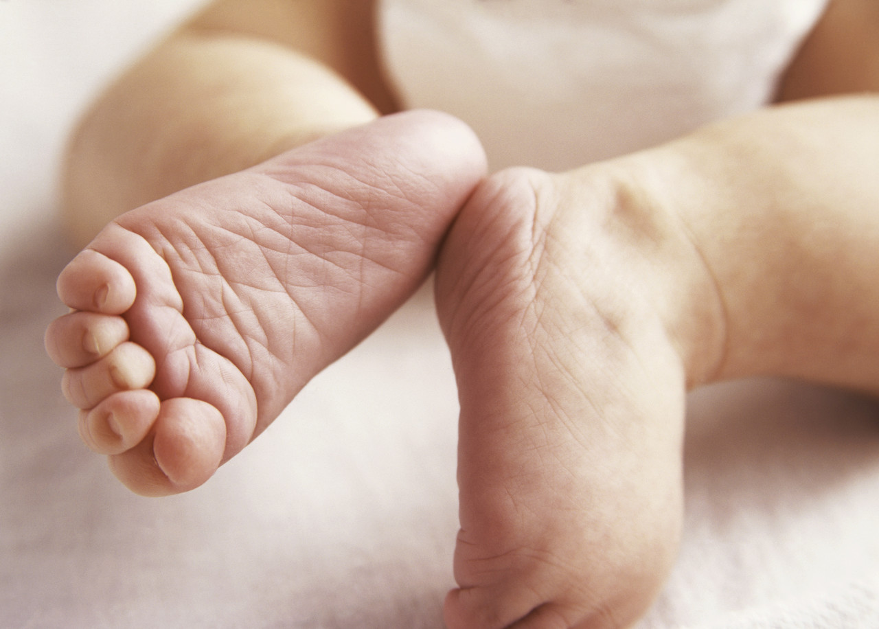 Drug Cuts Pain in Sickle Cell Infants