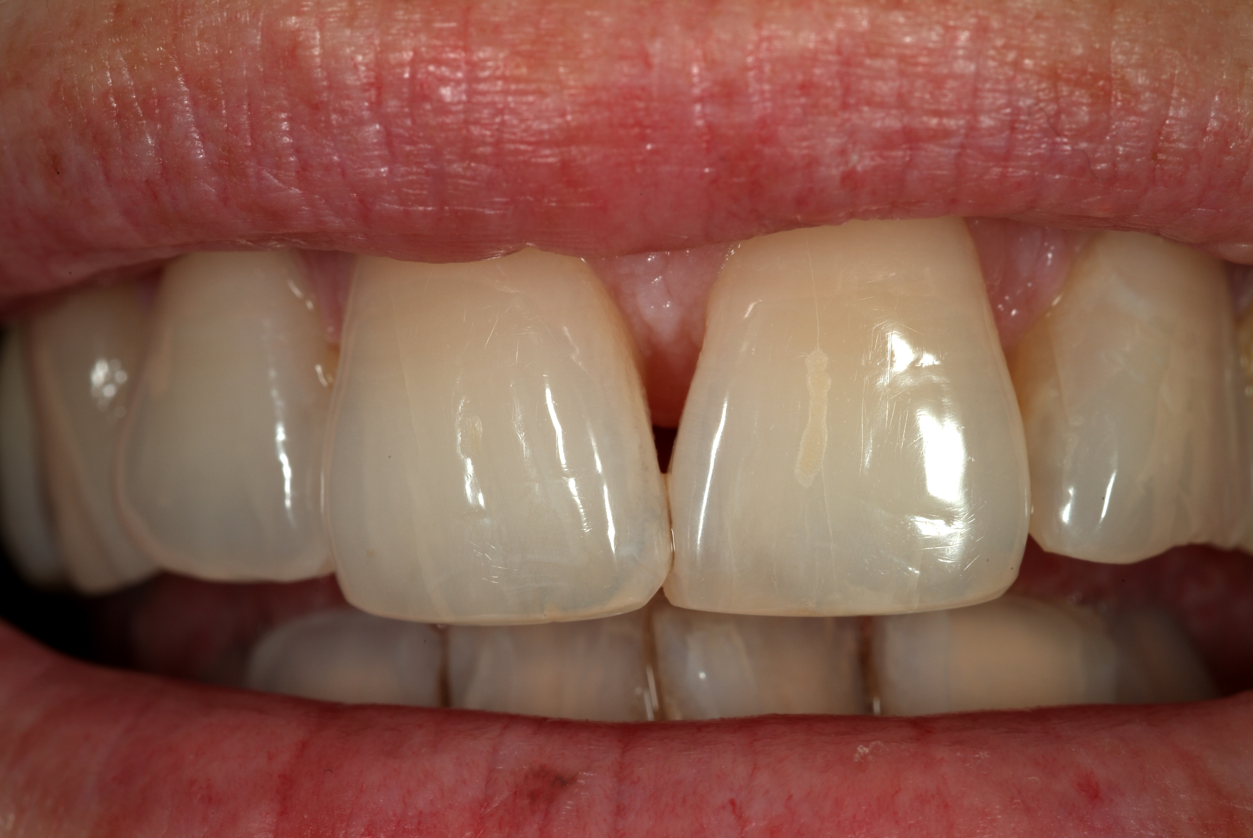 High Cost of Dental Care at the Hospital