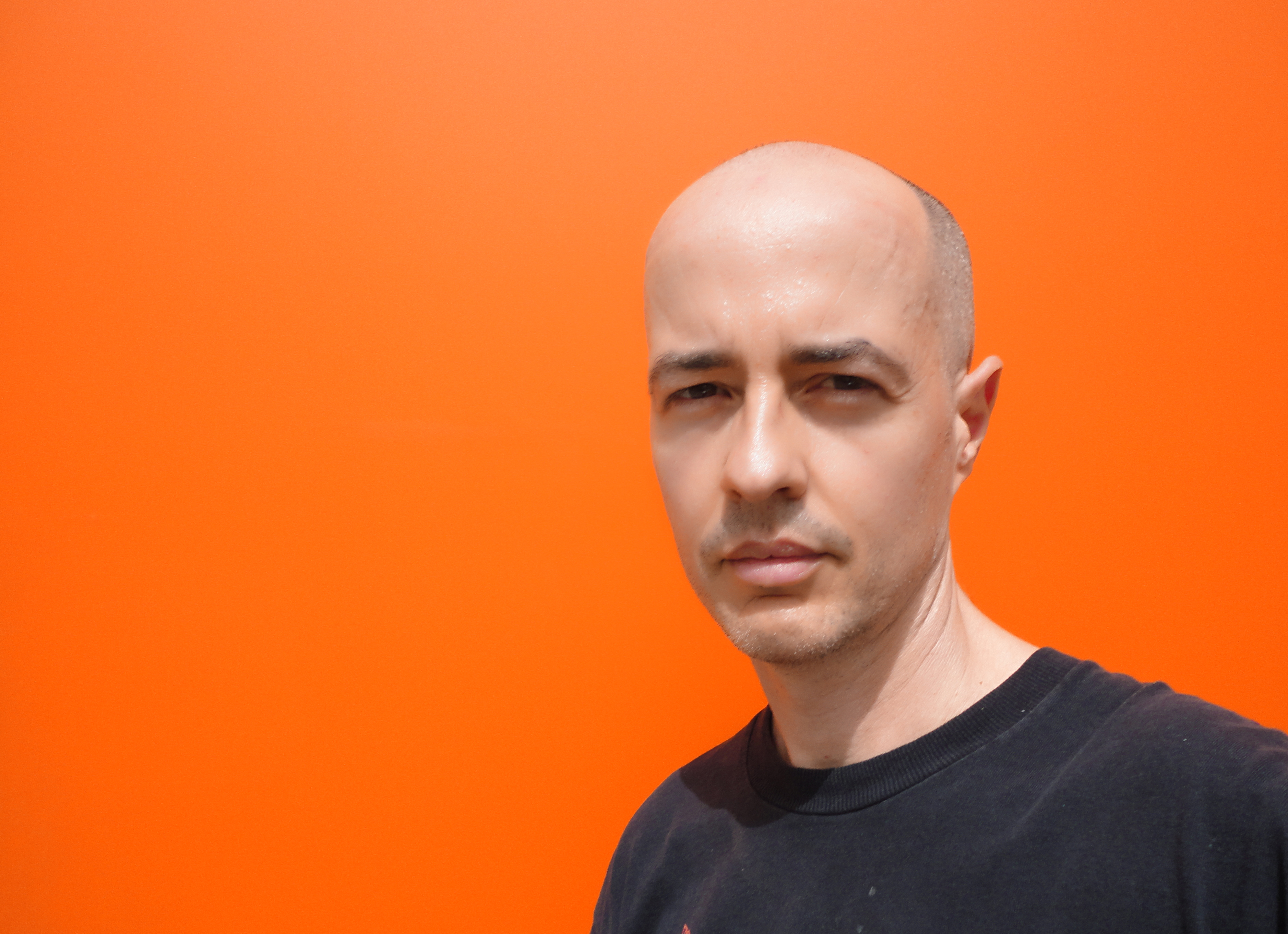 Anti-Balding Rx Doesn’t Mix With Alcohol