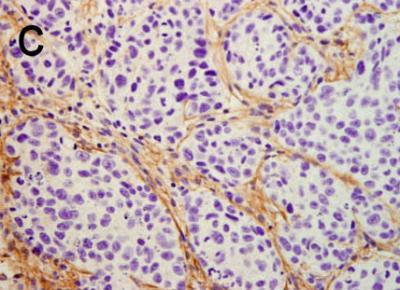 Cancer's "Cellular Orchestra Conductor" 