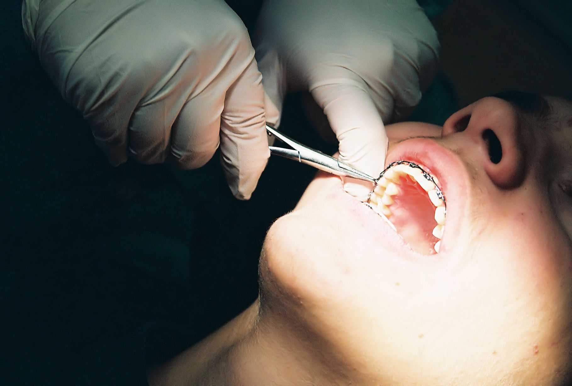 Birth Control Shots And Dental Health