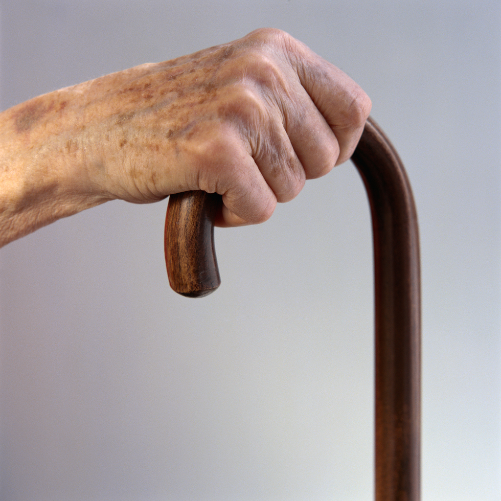 Disabled by Weight: Obese with Arthritis