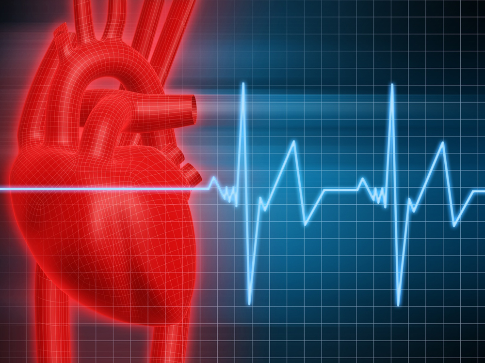 Mapping Key to Arrhythmia Treatment for Kids
