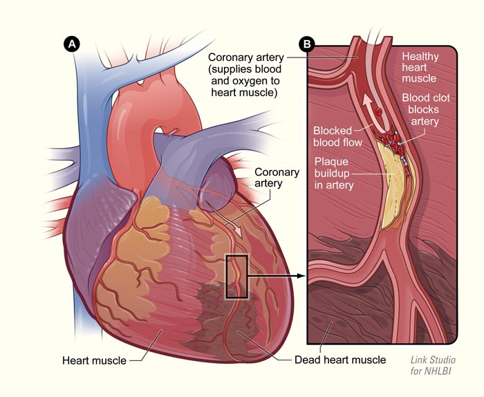 New Application for Bayer Heart Drug