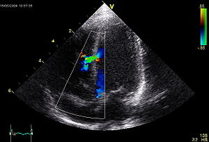 Liaison Coordinates Heart Care