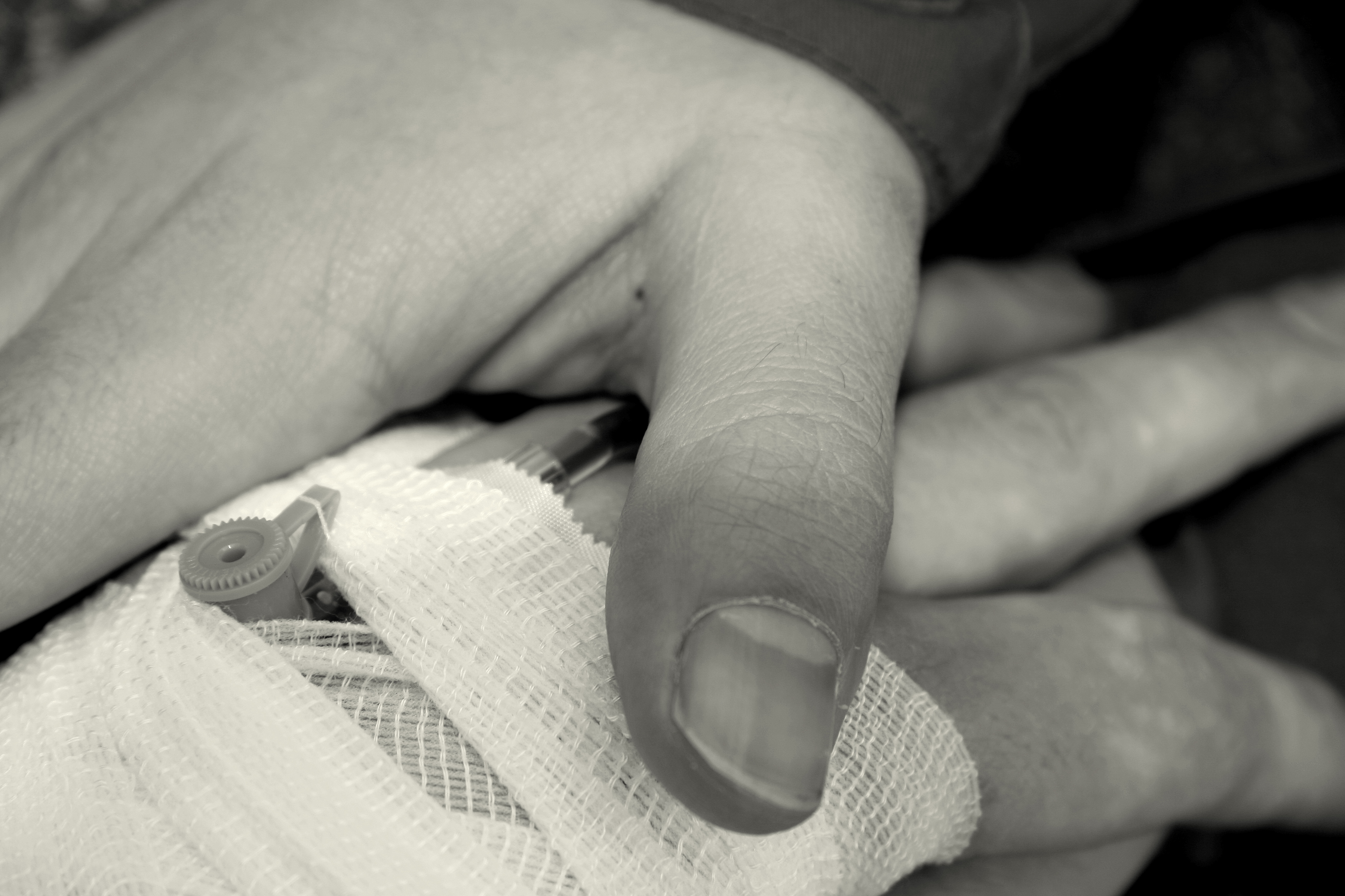 Few Changes in GI Bleeding Causes