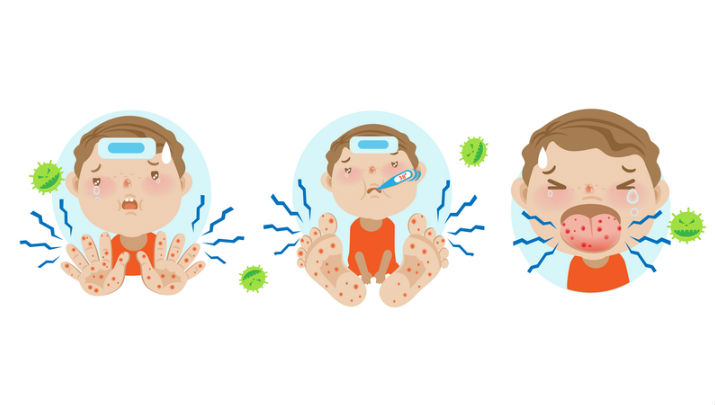 Back-to-School Illnesses: Hand, Foot and Mouth Disease