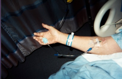 Lab-Grown Vein Implanted in Kidney Patient