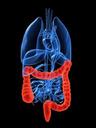 Bayer’s Metastatic Colorectal Cancer Drug Presented