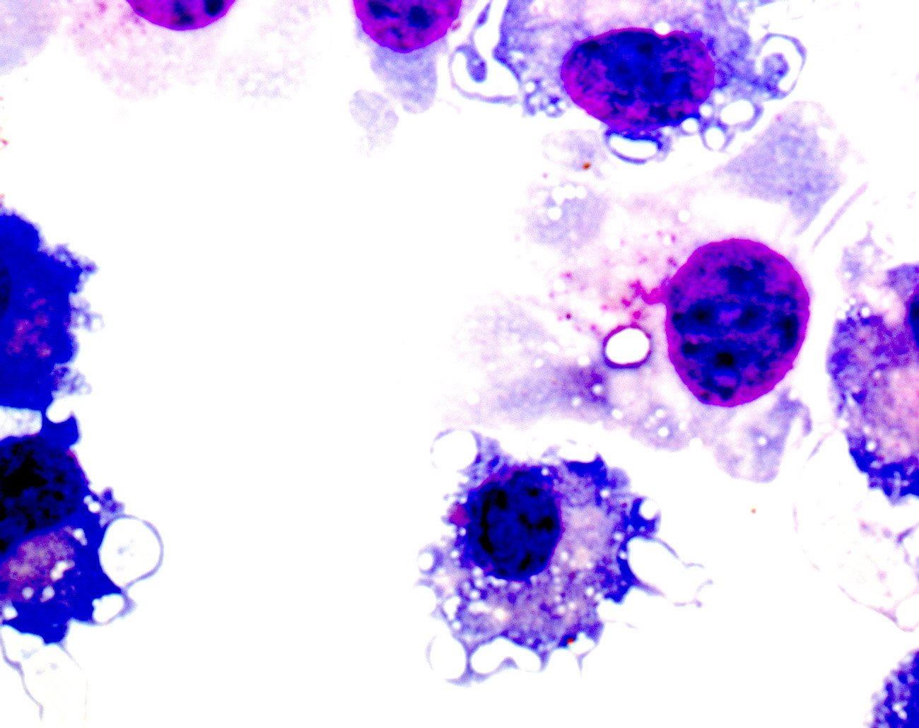 Viagra's Role in Battling Melanoma