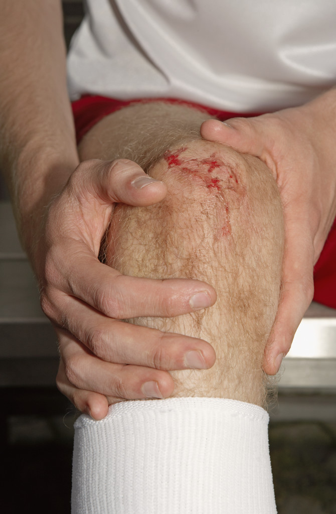 Running Injuries Running High