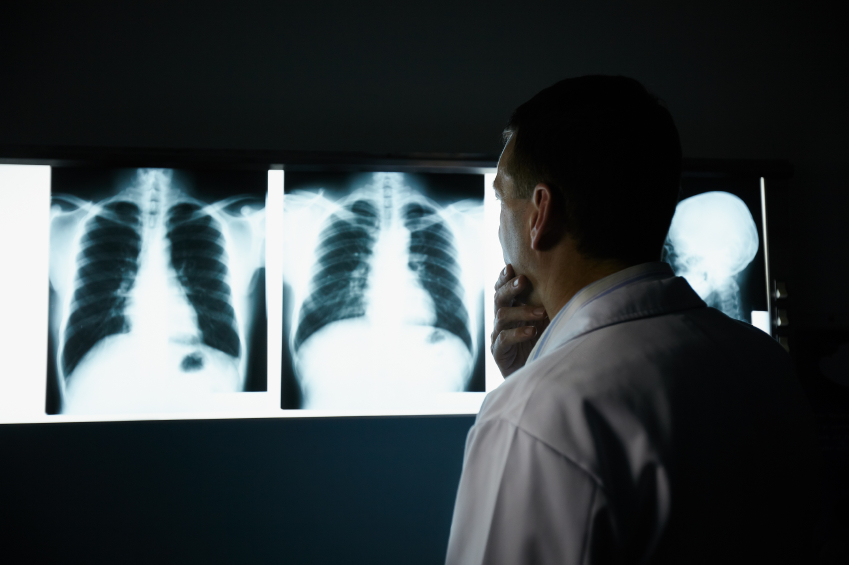 Newly Released Cancer Diagnostic Tests in Europe