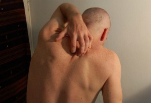 Ditch the Itch
